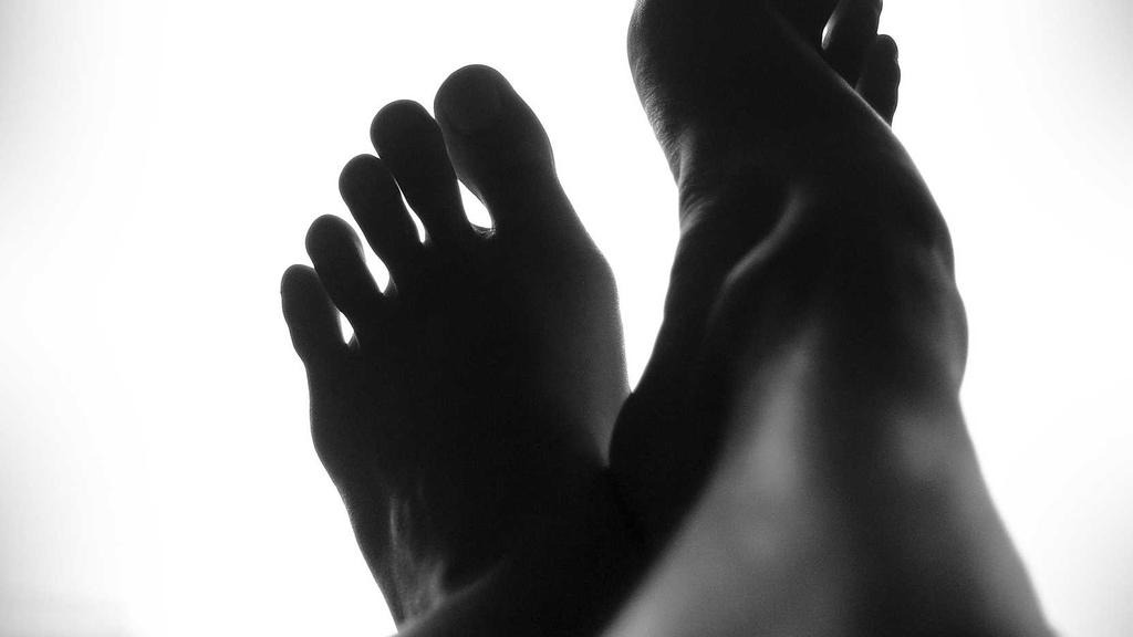 희귀질환 산정특례 대상 자격조건